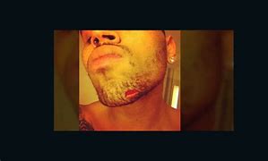 Image result for Rihanna Beat Up by Chris Brown