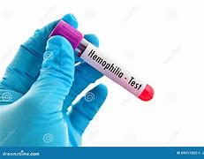 Image result for Hemophilia Blood Test