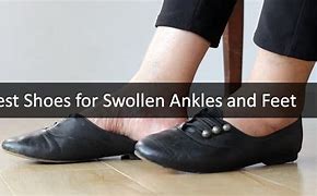 Image result for Shoes for Swollen Feet