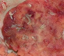 Image result for Maggots in Wounds