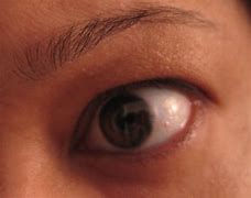 Image result for eye care 
