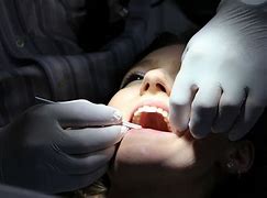 Image result for Teeth Scale Cleaning