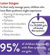 Image result for Rett Syndrome in Boys