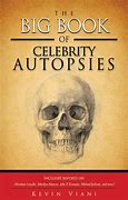 Image result for Celebrities Autopsies
