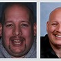 Image result for New Teeth Before and After