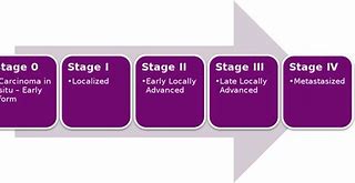Image result for Stage 4 Prostate Cancer Symptoms