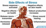 Image result for Stress Side Effects Body