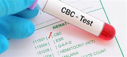 Image result for Complete Blood Count (CBC)