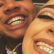 Image result for Couple W Grillz