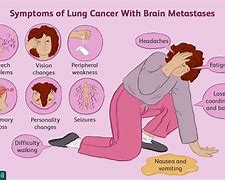 Image result for Surviving Stage 4 Lung Cancer