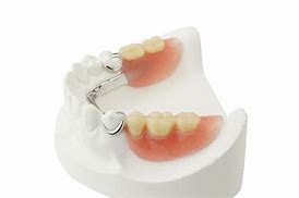 Image result for Partial Dentures
