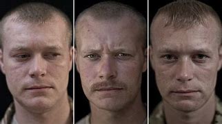 Image result for Battle Scars On Face of Soldiers