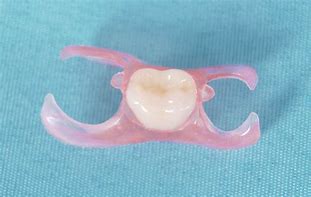 Image result for Flipper Partial Denture