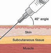 Image result for subcutaneous injections