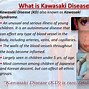 Image result for Symptoms Adult Kawasaki Disease