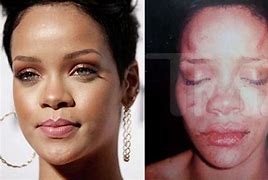 Image result for Rihanna Battue Chris Brown