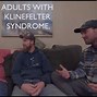 Image result for Klinefelter Syndrome Appearance