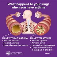 Image result for Asthma Cough Symptoms