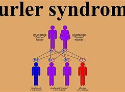 Image result for Hurler's Syndrome Prognosis