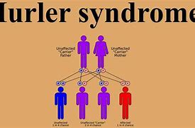 Image result for Hurler Syndrome Vertebral