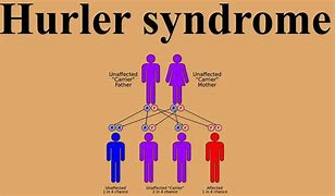 Image result for Hurler Syndrome Cornea