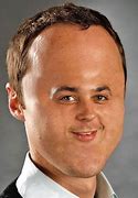 Image result for People with Big Heads