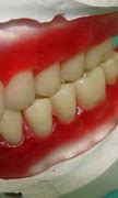 Image result for Well Teeth
