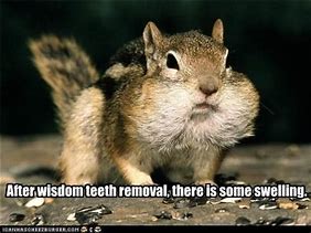 Image result for Funny Wisdom Tooth