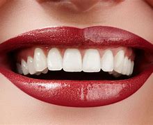 Image result for tooth veneers
