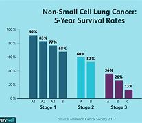 Image result for Lung Cancer Stage 4 People