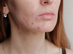 Image result for Blemish Meaning