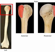 Image result for Greater and Lesser Tubercle Humerus