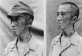 Image result for Hiroshima Atomic Bomb Human Shadows