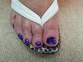 Image result for Pedicure Flip Flop Sandals
