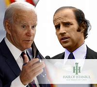 Image result for Joe Biden Hair Growth