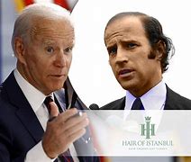 Image result for Joe Biden Hair Loss