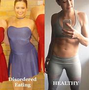 Image result for Eating Disorder Before and After