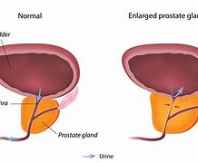 Image result for Prostate Parts