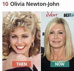 Image result for Olivia Newton-John Plastic Surgery
