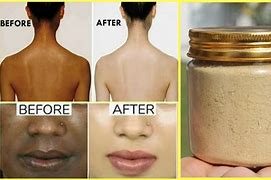 Image result for Skin Whitening Tips