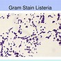 Image result for Listeria Culture