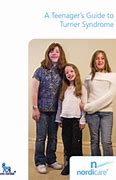 Image result for Teenagers with Turner Syndrome