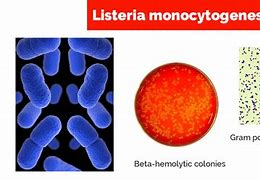 Image result for Listeria Mono