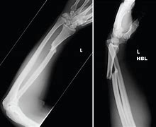 Image result for Orthopedic X-rays