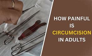 Image result for Circumcision