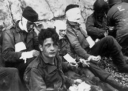 Image result for World War 1 Wounded