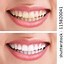 Image result for Jacinda Ardern Teeth