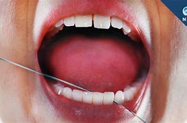 Image result for Water Flossing