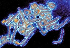 Image result for Marburg Virus