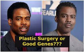 Image result for Chris Rock Plastic Surgery